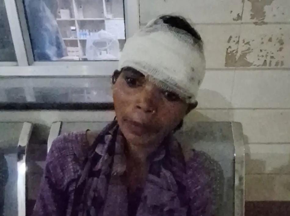 अमेठी में बंटवारे के विवाद में मां बेटी से मारपीट करीडीह गांव में महिला के सिर में चोट ट्रामा सेंटर में भर्ती
