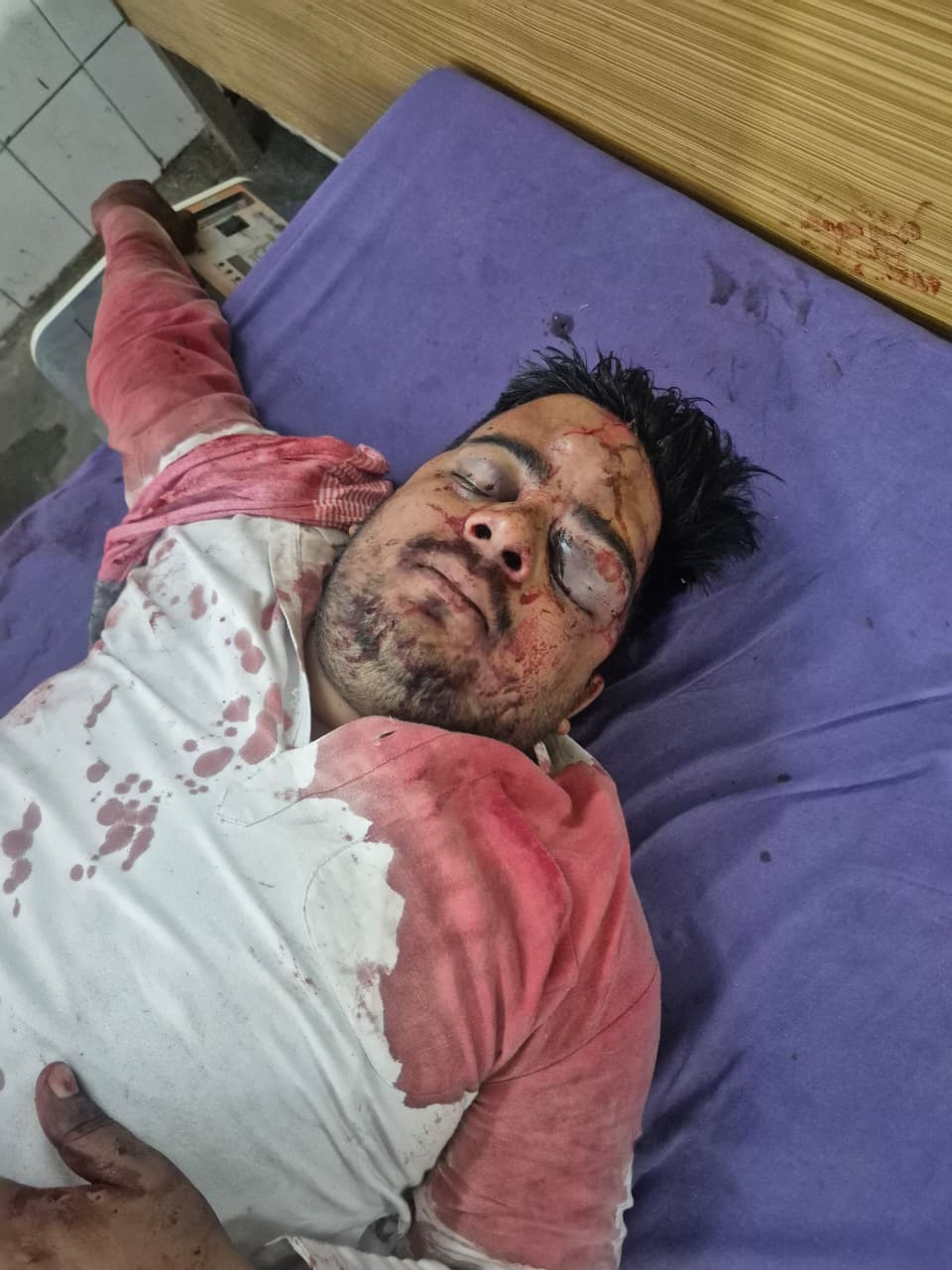 पूरनपुर में आधी रात भीषण सड़क हादसा, बिजली के खंभे से टकराई क्रेटा; पांच गंभीर घायल